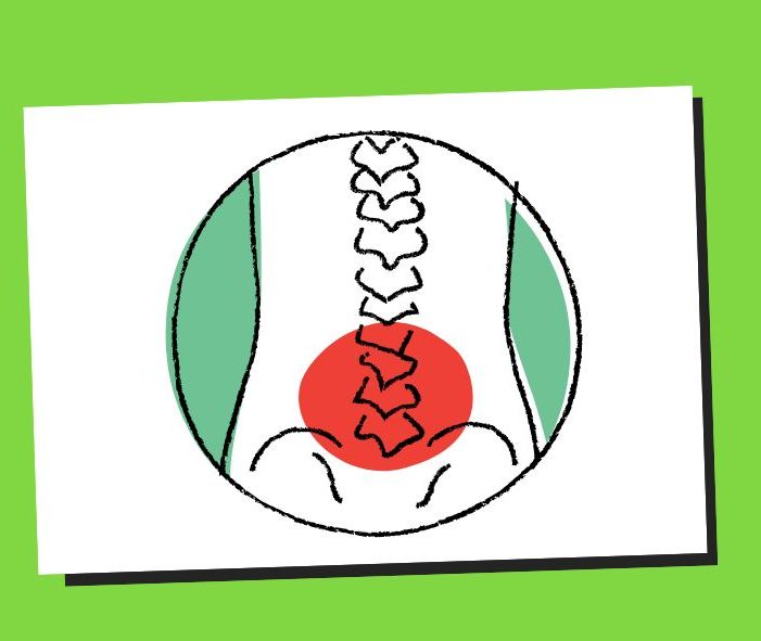 Back Pain 02